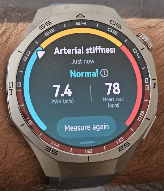 HUAWEI WATCH GT 5 Pro Ã®È›i poate evalua rigiditatea arterialÄƒ