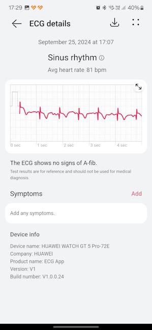 O analizÄƒ ECG efectuatÄƒ pe HUAWEI WATCH GT 5 Pro