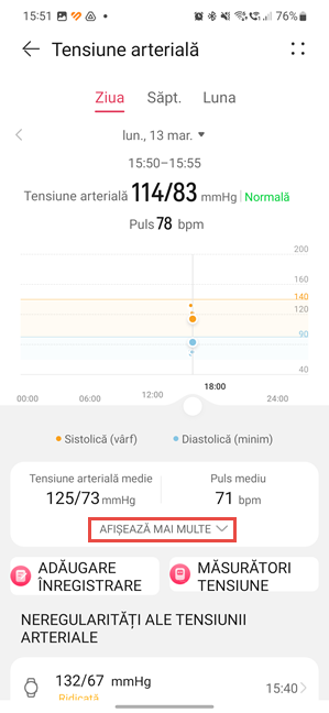 ApasÄƒ pe AfiÈ™eazÄƒ mai multe